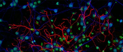 Avancées technologiques en microscopie à fluorescence